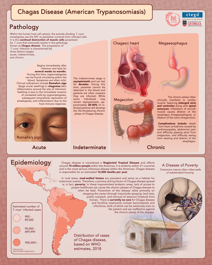 chagas disease