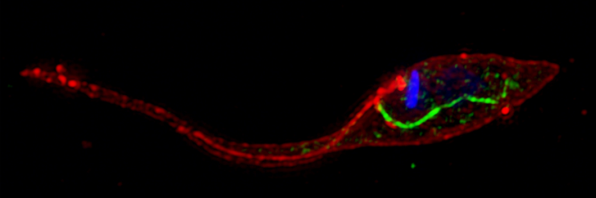 Trypanosoma cruzi